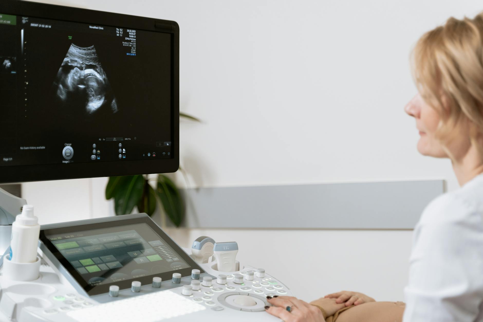 photo of person using ultrasound scan