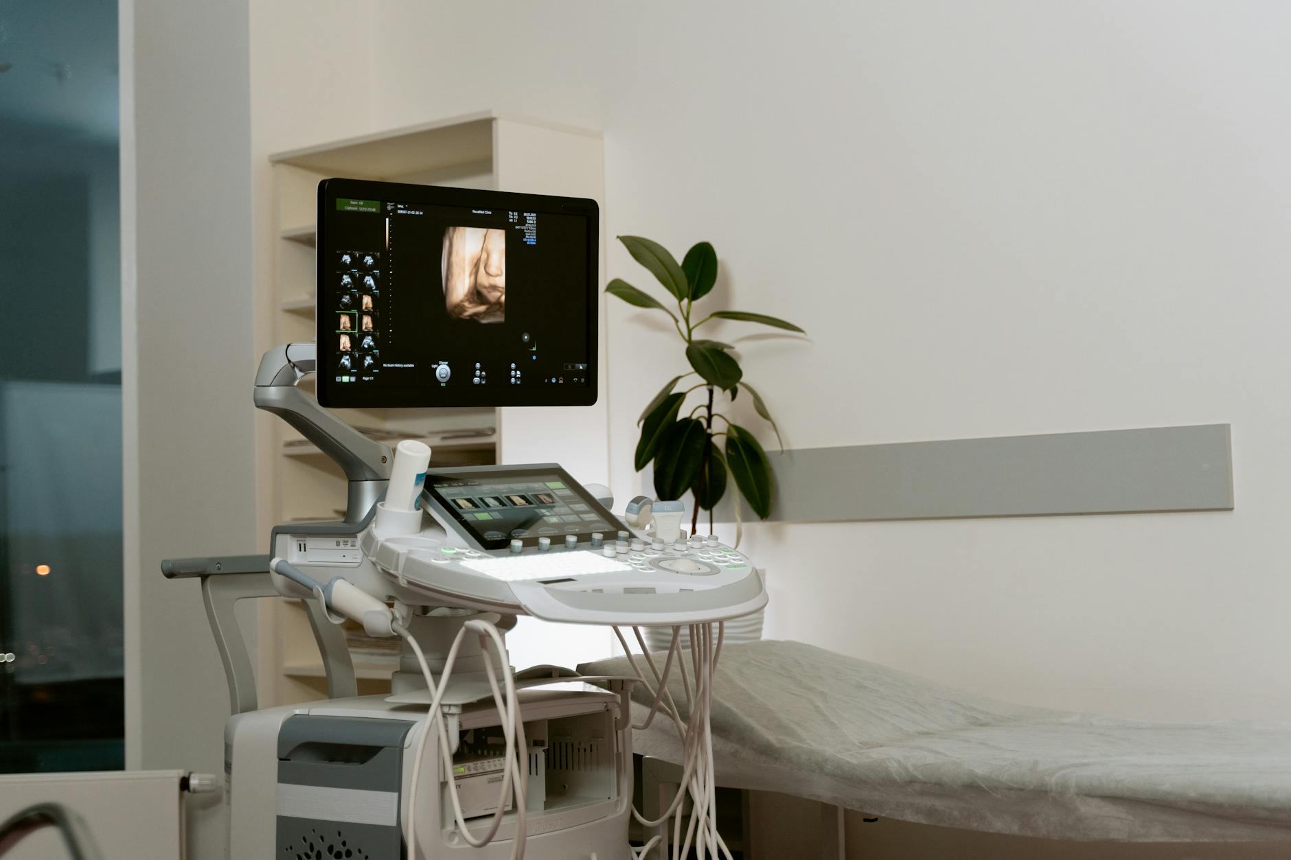 photo of ultrasound scanner